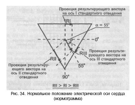 Електрическа ос и електрически сърцето позиция