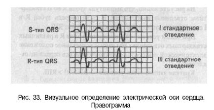 Електрическа ос и електрически сърцето позиция