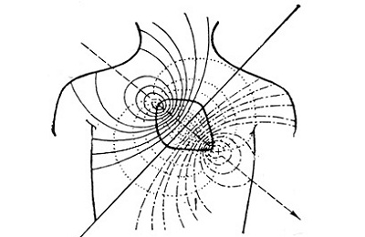 Схема сърцето ос отклонение, позицията на вертикални и хоризонтални