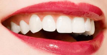 Колко бързо побелява зъби, без да вреди на дома, блог Алена Кравченко