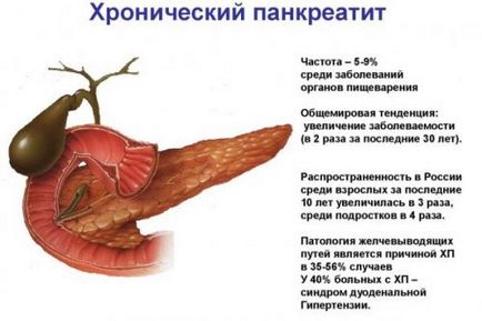 Как боли панкреаса при хора основните симптоми