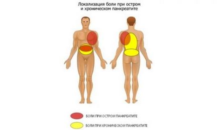 Как боли панкреаса при хора основните симптоми