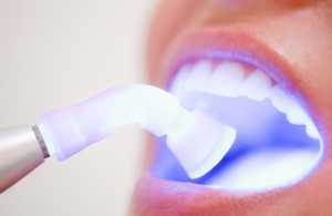 Как да избелите зъбите си у дома бързо, безопасно, без да навреди