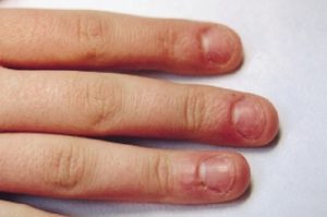 Как да се отучат от ухапване ноктите си в ръцете на възрастен
