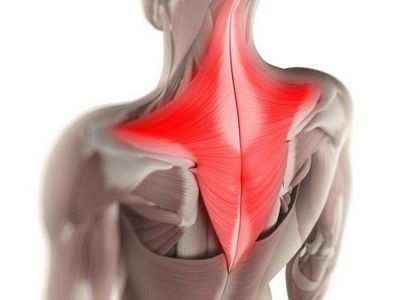 Как да се облекчи болката на мускулите на гърба