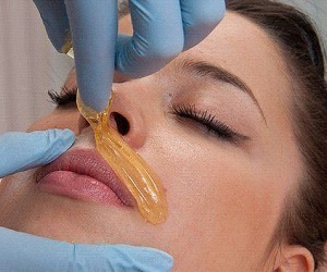 Как да премахнете окосмяването по лицето постоянно у дома най-ефективните методи