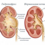 Как да се сложи бебето да спи Komarovka