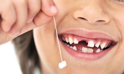 Когато децата падат млечните зъби - загуба верига