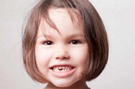 Когато есента млечните зъби при децата и препоръки подробна схема на родителите