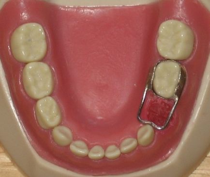 При падане млечни зъби при деца последователност и времето