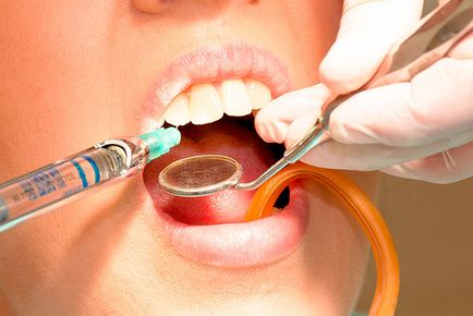 Лекарствени продукти за анестезия в стоматологията