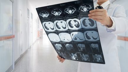 MRI на корема, който показва подготовката за изучаване