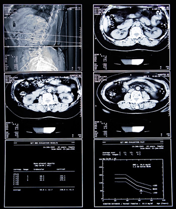 ЯМР на корема - получаване и стойността на MRI на вътрешните органи на коремната кухина