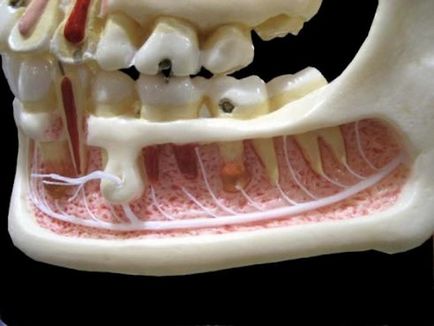 Анестезия в стоматологията - лекарства и класификация