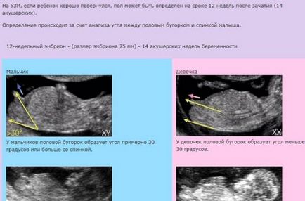 Определяне на пола на ударите на сърцето на детето в продължение на 12 седмици - да се определи какво тоновете на плода,