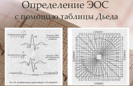 Ос отклонение наляво диагноза тактиката (вляво) Ос отклонение наляво диагноза тактики