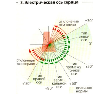 Ос отклонение наляво диагноза тактики