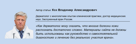 Защо сърбеж пръстите на краката - да са здрави