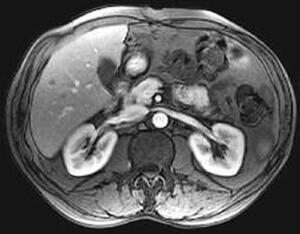 Подготовка за процедура на MRI, сложността на коремната кухина