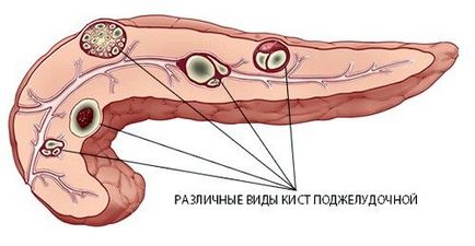 панкреаса симптоми