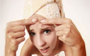 Акне на челото си при жените - причини, лечение, профилактика