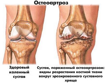 Кликнете на ставите предизвиква лечение