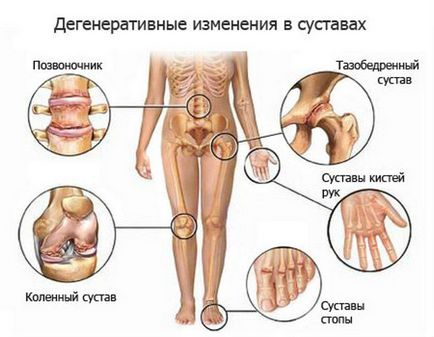 Кликнете на ставите предизвиква лечение