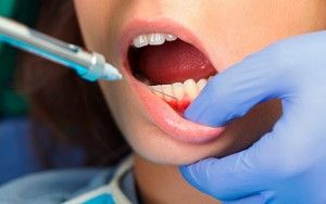 Съвременните локални анестетици в класификацията стоматология