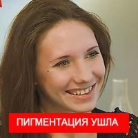 Спрей за плешивост при мъжете - generolon, alerana (алопеция) Спрей за плешивост при мъжете - generolon, alerana