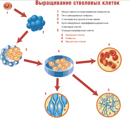 Използване на човешки стволови клетки от пъпна терапия кръв от пъпна връв стволови клетки