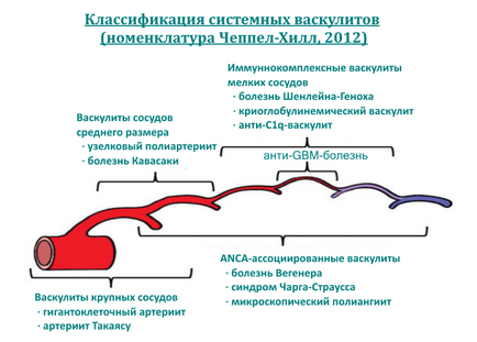 Васкулитни диагностика, симптоми и лечение на народната медицина