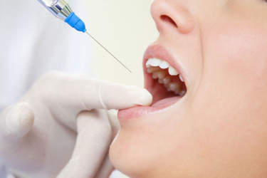 Видове анестезия в стоматологията