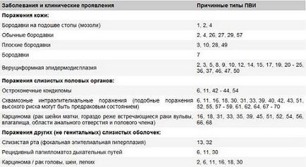 Човешки папилома вирус снимка, симптоми и лечение