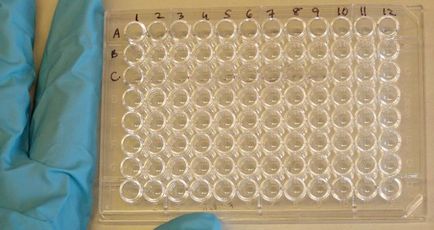 Chlamydia това е, видовете, причини, симптоми, лечение, профилактика