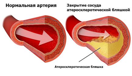 Съдово заболяване на долните крайници причините и симптомите