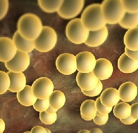 Staphylococcus ауреус симптоми, лечението с, снимки