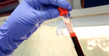 Как да се увеличи хемоглобина лекарства Как да се увеличи хемоглобина лекарства