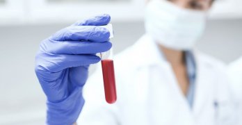 Как да се увеличи хемоглобина лекарства Как да се увеличи хемоглобина лекарства
