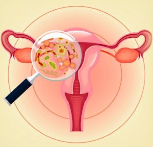 Gardnerella Vaginalis (gardenela жените) симптоми и лечение, където има над опасната