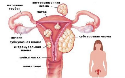 Защо може да се освободи Защо може да се освободи