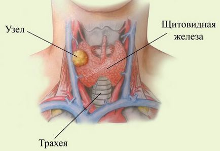 Разширената функция на щитовидната жлеза, че е