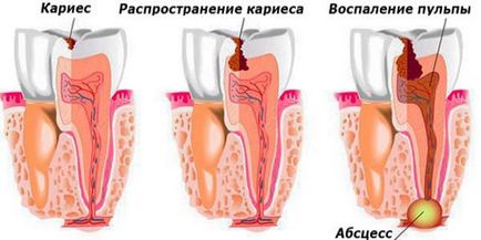 зъбобол на удара