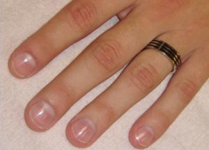 Как да се промени формата на ноктите у дома си в ръцете на