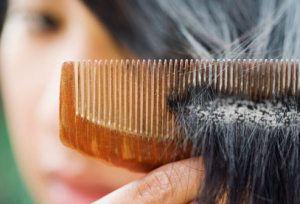 Проблеми с косата - как да се отнасяме и до каква лекар за справяне