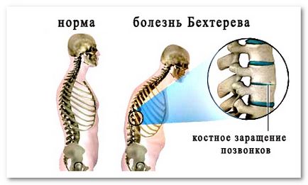 Симптоми и лечение на болки в гърба