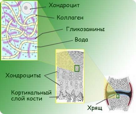 Възстановяване на хрущяла на ставите пакет от мерки в коляното да се лекува