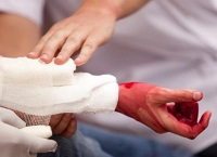 Артериална кървене симптоми и оказване на първа помощ, как да се спре кървенето