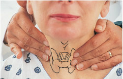 На опасните сайтове в щитовидната жлеза