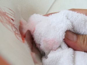 Как да се измие кръвта от дивана и олово място