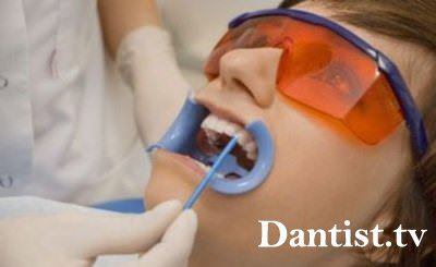 Миенето на зъбите в цената на зъболекар и снимките
